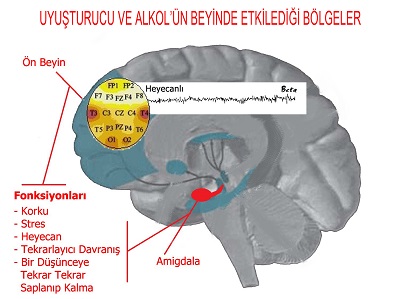 Bonzai öldürüyor